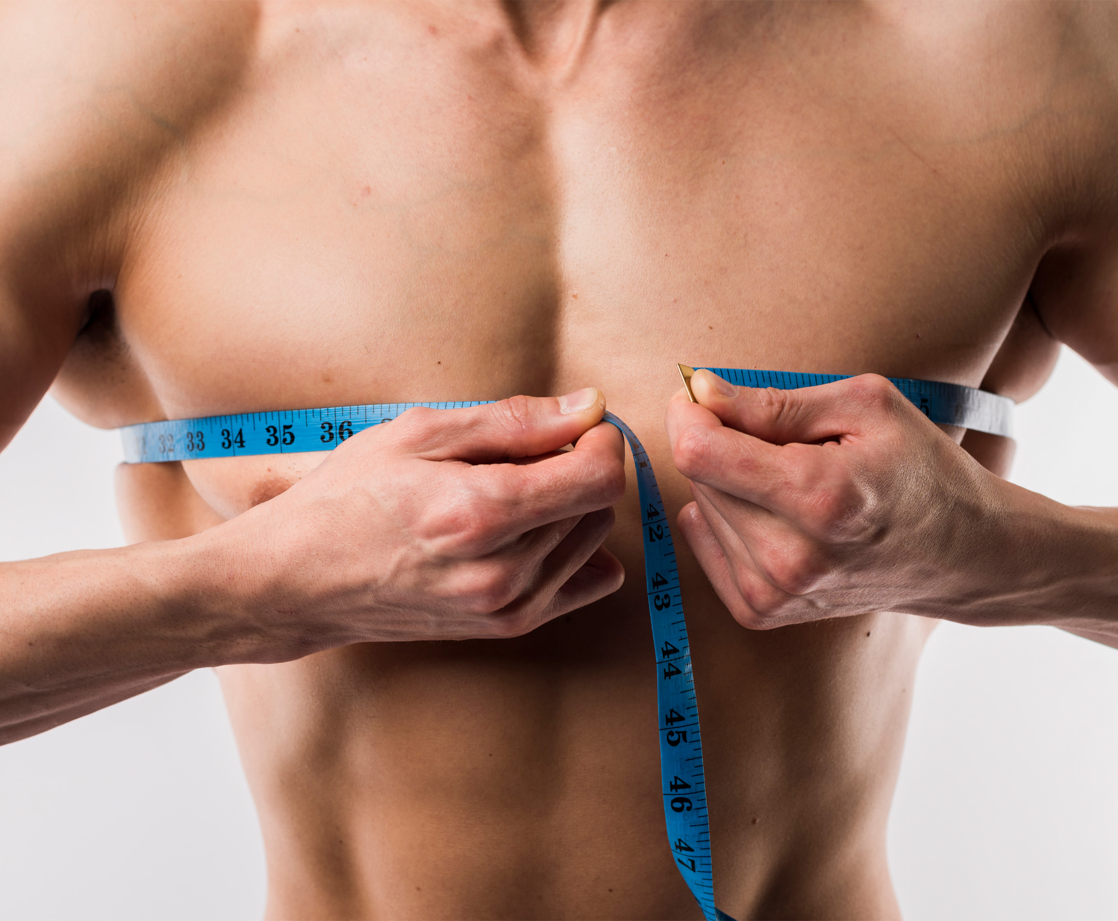 Gynecomastia